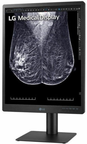 LG 21.3" 5MP IPS Diagnostic Monitor for Mammography